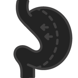 gastric-sleeve